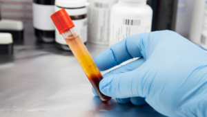 A doctor holding a vial of plasma