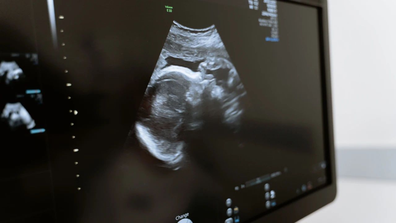 Close-up of an ultrasound scan displayed on a medical monitor in a clinical environment.
